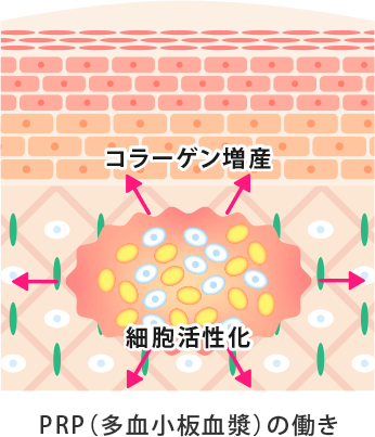 狭心症は死を引き起こす可能性があります