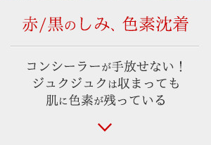 赤/黒のしみ、色素沈着 - コンシーラーが手放せない！ジュクジュクは収まっても肌に色素が残っている