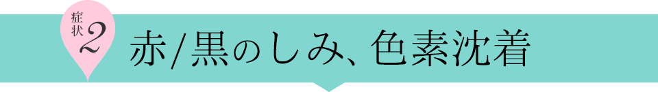 症例2 - 赤/黒のしみ、色素沈着