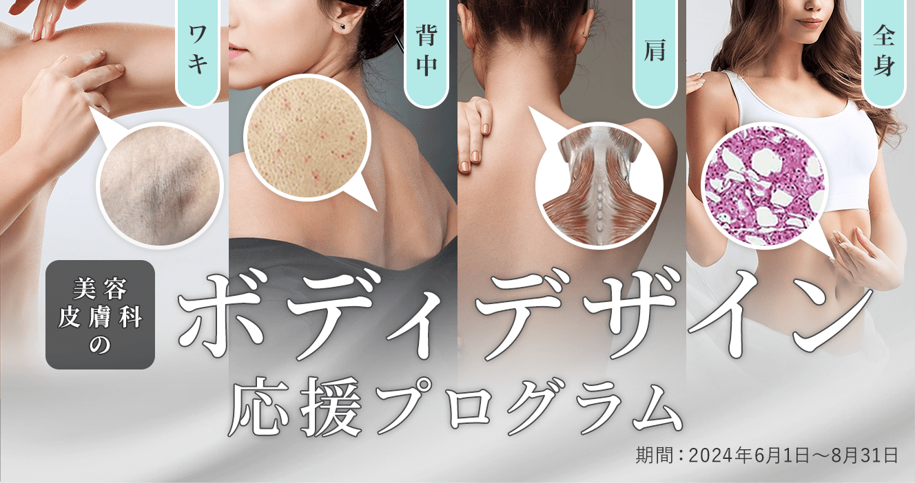 ボディデザイン応援プログラム