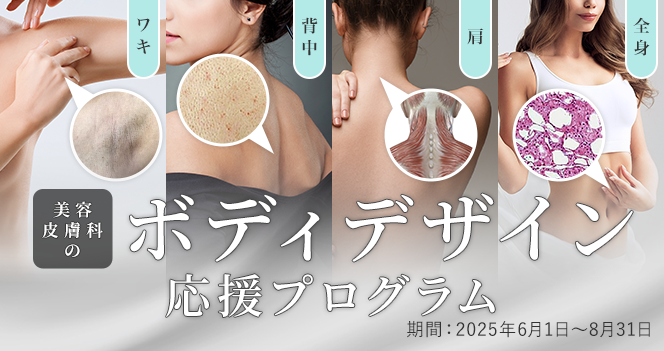 ボディデザイン応援プログラム
