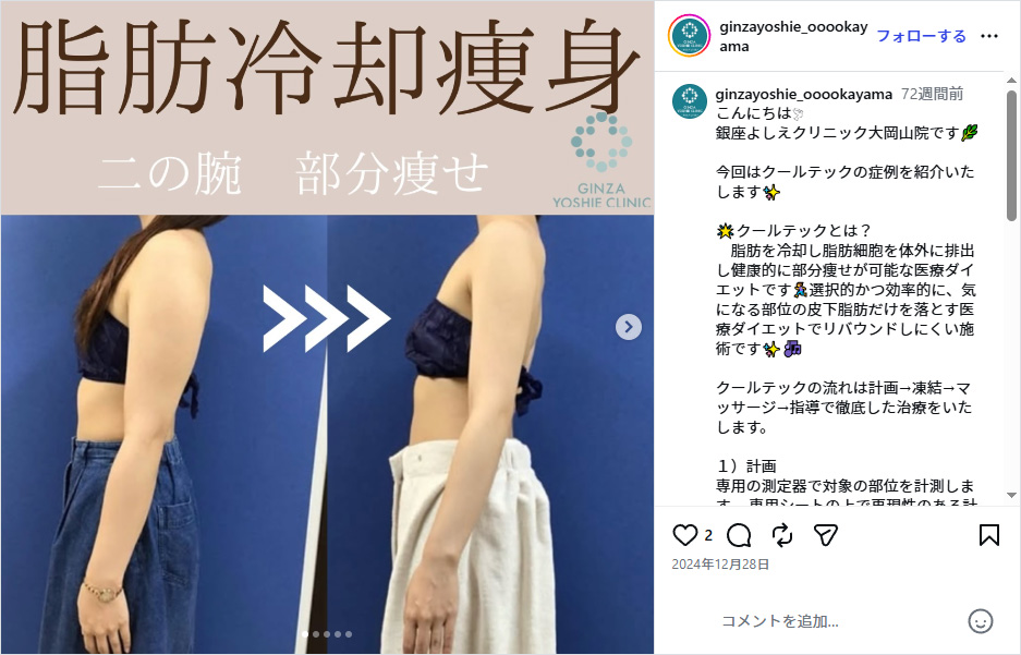 銀座よしえクリニックインスタグラム