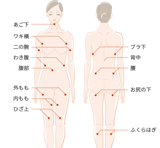 脂肪冷却痩身の適応部位