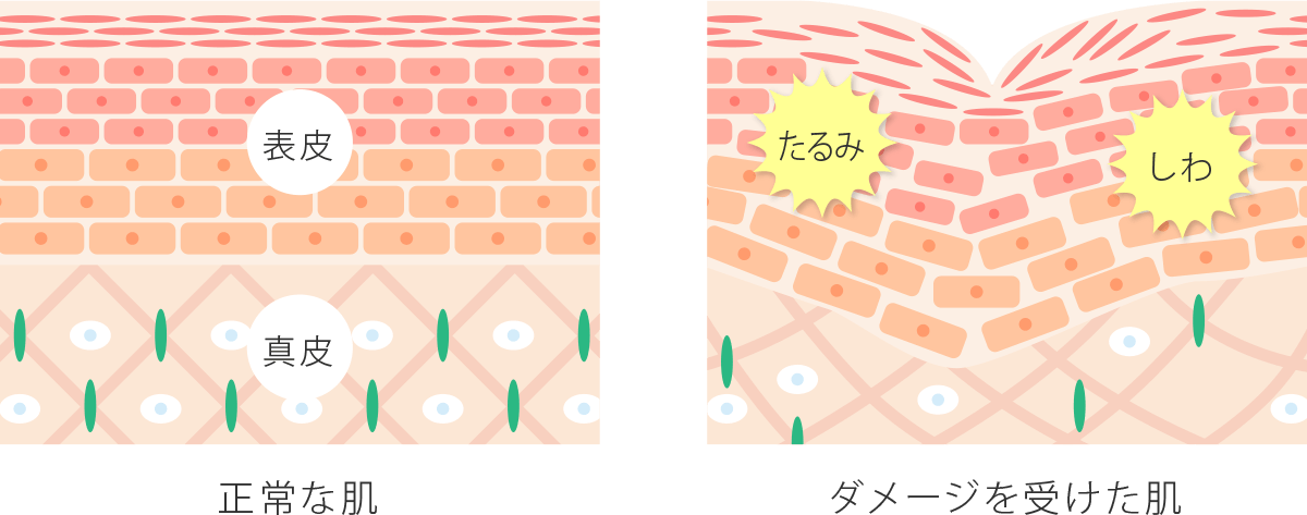 体、首、顔の皮膚のたるみの原因