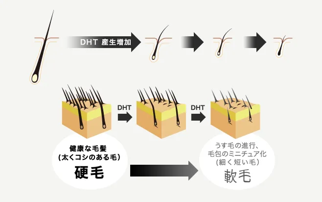 AGAのしくみ