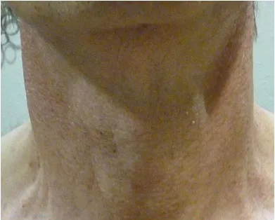 体 首 顔の皮膚のたるみ引き締め治療 美容皮膚科 銀座よしえクリニック 公式 東京