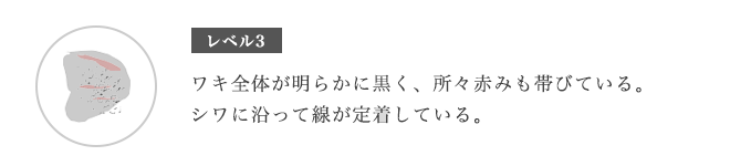 脇の黒ずみの原因:レベル3