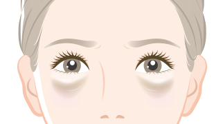 目元のたるみ 目の下のクマ治療 美容皮膚科 銀座よしえクリニック 公式 東京