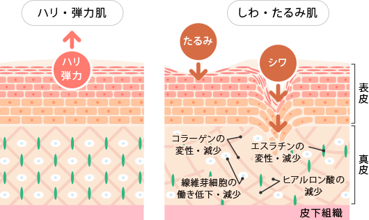しわ たるみ 美容皮膚科 銀座よしえクリニック 公式 東京 しわ たるみ 美容皮膚科 銀座よしえクリニック 公式 東京
