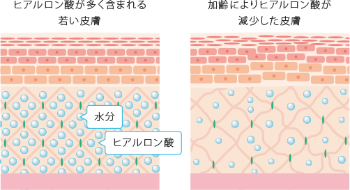 ヒアルロン酸注射 注入 の効果と値段 美容皮膚科 銀座よしえクリニック 公式 東京