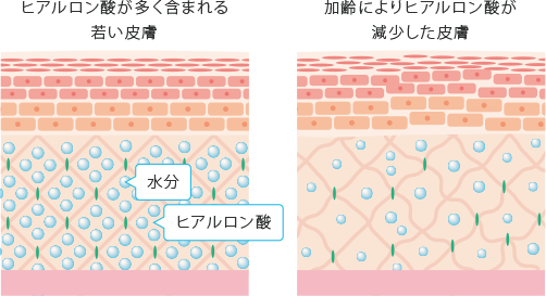ヒアルロン酸注射 注入 の効果と値段 美容皮膚科 銀座よしえクリニック 公式 東京 ヒアルロン酸注射 注入 の効果と値段 美容皮膚科 銀座よしえクリニック 公式 東京