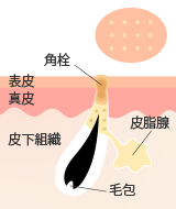 毛穴のつまり