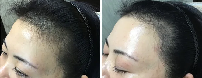 ブラック　ヘアラインシャドウ   　生え際パウダー
