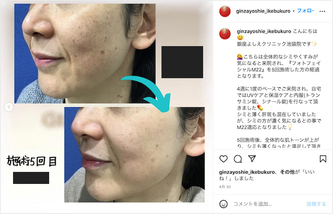 インスタグラム