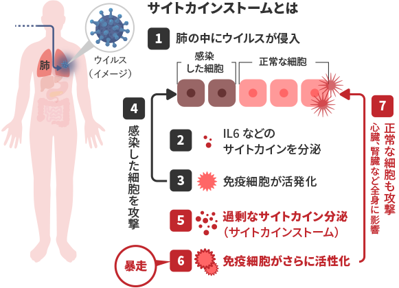 サイトカインストームとは