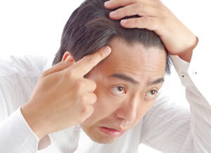 内服治療(男性)