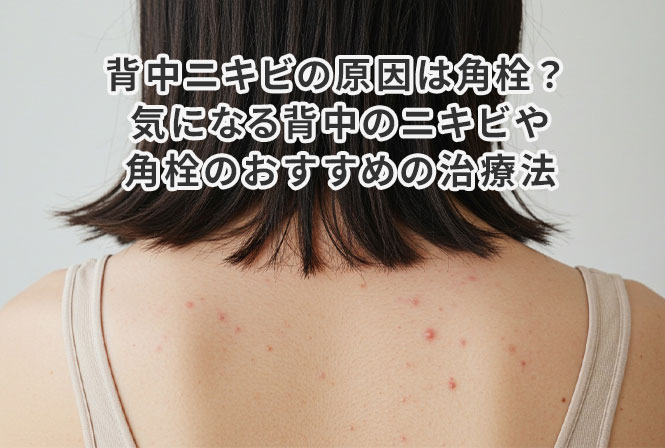 背中ニキビの原因は角栓？ 気になる背中のニキビや角栓のおすすめの治療法