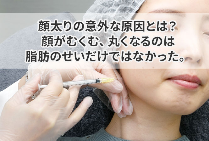 顔太りの意外な原因とは?顔がむくむ、丸くなるのは脂肪のせいだけではなかった。