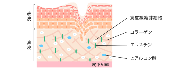 肌断面図