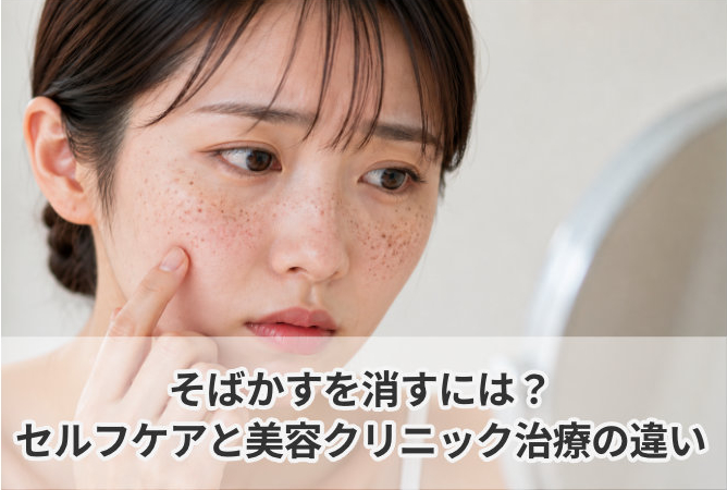そばかすを消すには?セルフケアと美容クリニック治療の違い