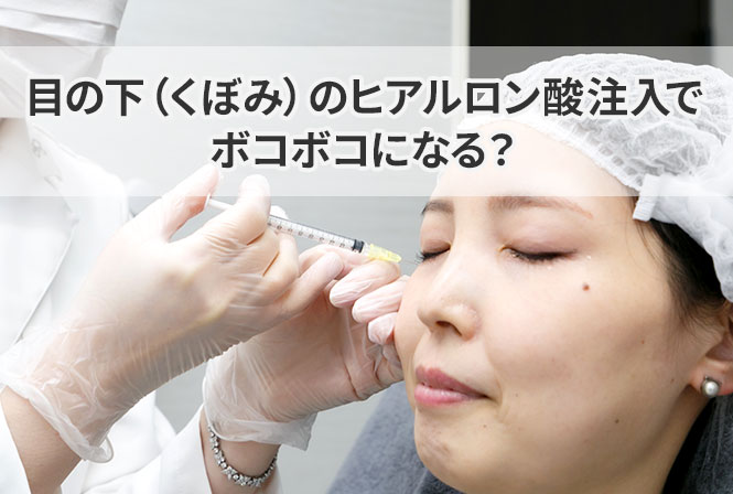 目の下(くぼみ)のヒアルロン酸注入でボコボコになる?チンダル現象などの失敗を避ける対処法
