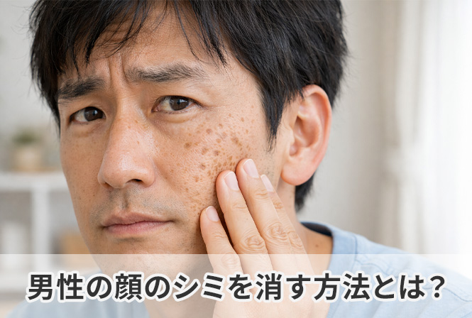 男性の顔のシミを消す方法とは？原因から正しい対策まで医師が解説します。