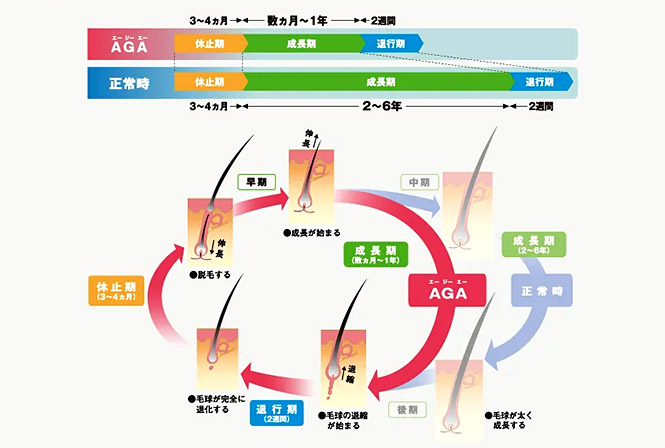 男女問わずお悩みの方が多い薄毛やはげ（禿髪）。再生医療による最新のハゲ治療をご紹介します