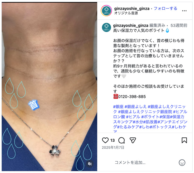 銀座よしえクリニックインスタグラム