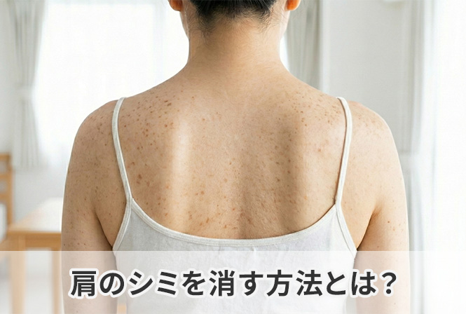 肩のシミを消す方法とは?知らないと悪化する6つの原因
