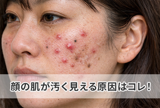 顔の肌が汚く見える原因はコレ！皮膚科医が教えるセルフケアと美容医療