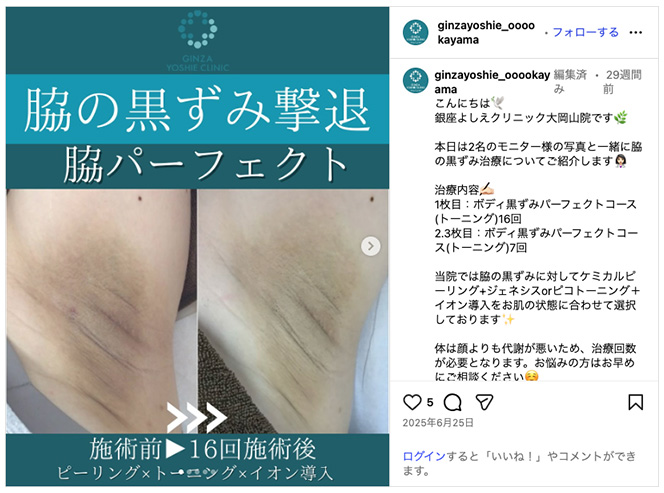 銀座よしえクリニックインスタグラム