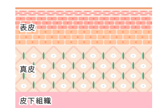 クレーターを改善